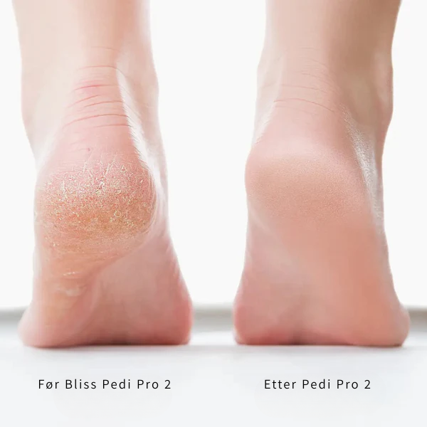 Pedi Pro 2 – Silkemyke føtter på sekunder
