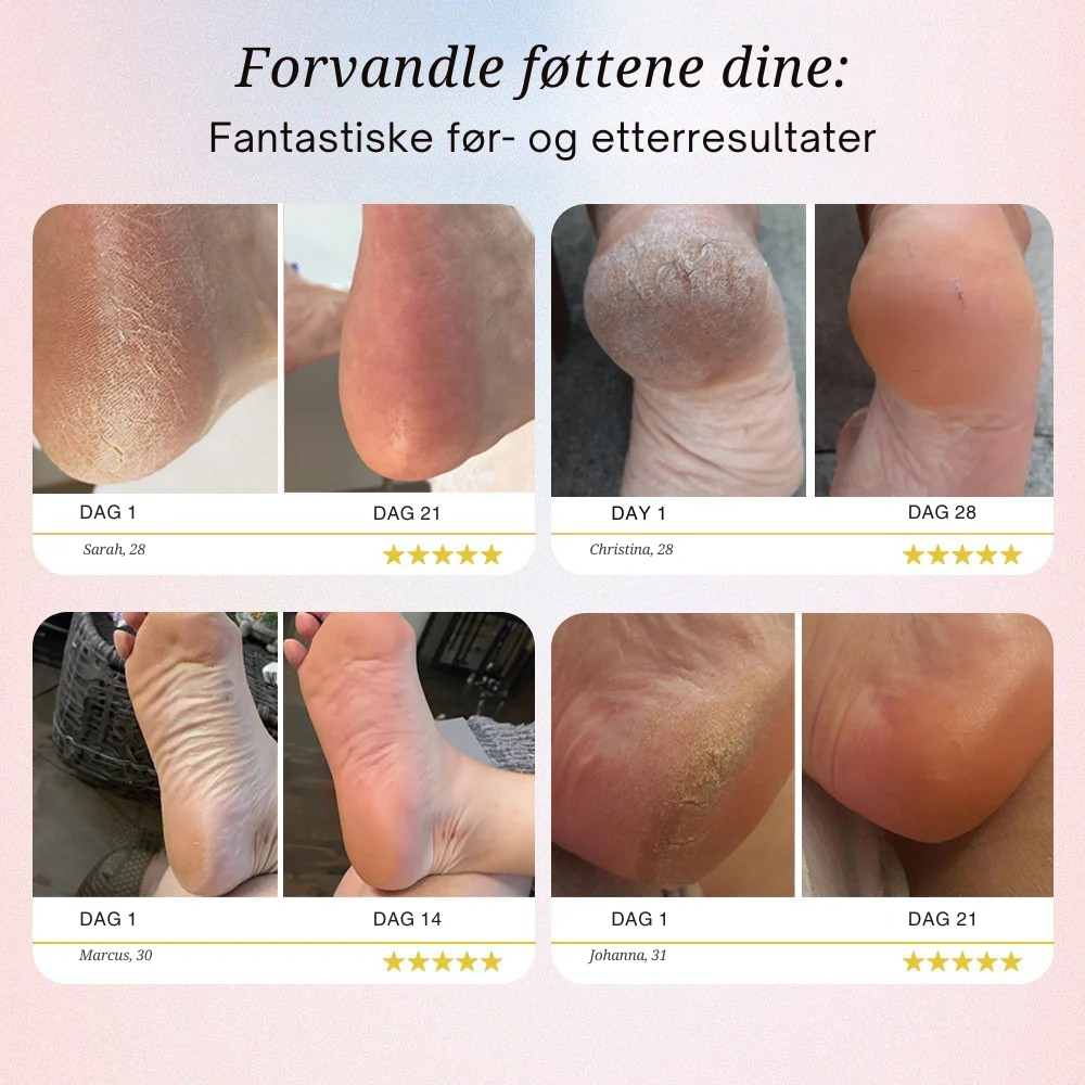Pedi Pro 2 – Vår beste fotfil noensinne